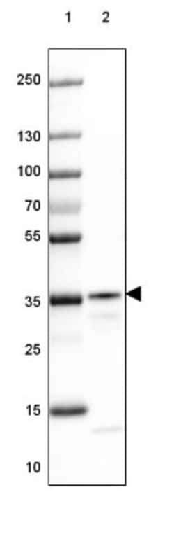 RABGGTB Antibody, Novus Biologicals 25 &mu;L | Buy Online | Novus Biologicals | Fisher Scientific